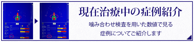 現在治療中の症例紹介
