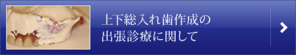 上下総入れ歯作成の出張診療に関して