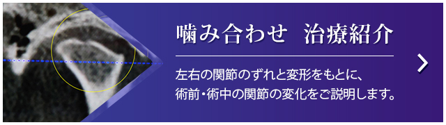 噛み合わせ　治療紹介