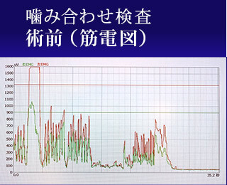 術前（筋電図）
